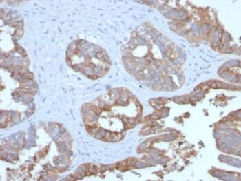 MUC1 / CA15-3 / EMA / CD227 (Epithelial Marker) (MUC1/2729R), CF740 conjugate, 0.1mg/mL