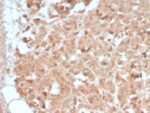 CELA3B / ELA3B (Pancreatic Function Marker) (CELA3B/2809R), CF640R conjugate, 0.1mg/mL