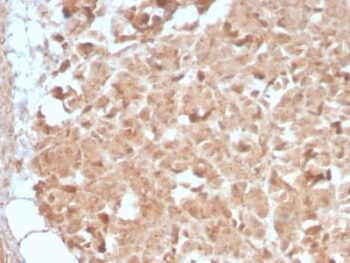 CELA3B / ELA3B (Pancreatic Function Marker) (CELA3B/2809R), CF640R conjugate, 0.1mg/mL