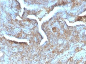 Thymidine Phosphorylase / PD-ECGF (Angiogenesis Marker) (TYMP/2890R), Biotin conjugate, 0.1mg/mL