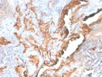 Tenascin C (Stromal Marker For Epithelial Malignancy) (TNC/2981R), Biotin conjugate, 0.1mg/mL