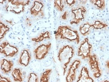 Renal Cell Carcinoma (Carbonic Anhydrase IX) (CA9/2993R), 0.2mg/mL