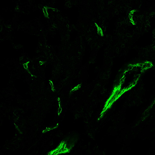 CD31-BNC881099-human-tonsil-vessels CD31 BNC881099 human tonsil vessels- Immunomart