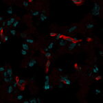CD31-PECAM-C31.7-CF555-Histone-H1-HH1-957-CF647-human-brain
