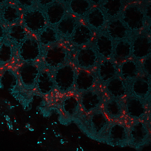 EPX AHE 1 colon- Immunomart