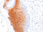 Cytokeratin 1 (Suprabasal Keratinocyte Marker)(LHK1), 0.2mg/mL 1 view_image-116