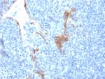 Cytokeratin 16 (KRT16) (Suprabasal Keratinocyte Marker)(LL025), CF647 conjugate, 0.1mg/mL