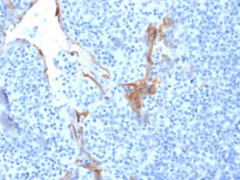 Cytokeratin 16 (KRT16) (Suprabasal Keratinocyte Marker)(LL025), CF647 conjugate, 0.1mg/mL