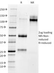 MMP3 (Marker of Metastasis and Rheumatoid Arthritis)(1B4), 0.2mg/mL