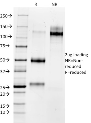 MMP3 (Marker of Metastasis and Rheumatoid Arthritis)(1B4), 0.2mg/mL