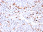S100A9 + Calprotectin (S100A8/A9 Complex)(MAC3157R), CF488A conjugate, 0.1mg/mL 1 view_image-123