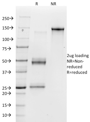 Vitronectin Receptor / CD51 / CD61(23C6), 0.2mg/mL