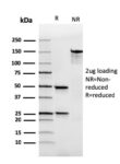 Human Immunoglobulin Alpha (IgA) Heavy Chain(rHISA43), 0.2mg/mL