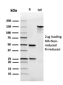 Human Immunoglobulin Alpha (IgA) Heavy Chain(rHISA43), 0.2mg/mL