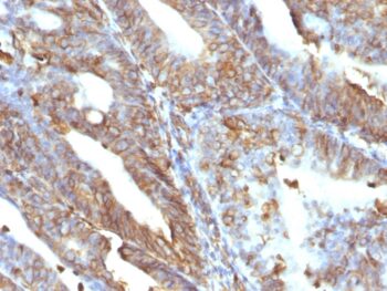 Vimentin (Mesenchymal Cell Marker)(V9), CF594 conjugate, 0.1mg/mL