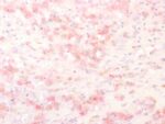 Tyrosinase-Related Protein-1 (TYRP-1) (Melanoma Marker), CF568 conjugate, 0.1mg/mL 1 view_image-193