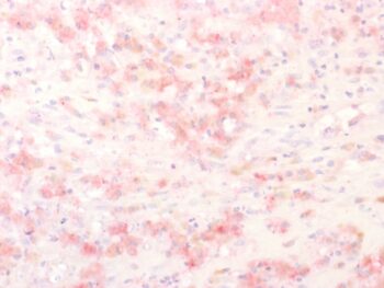 Tyrosinase-Related Protein-1 (TYRP-1) (Melanoma Marker), CF740 conjugate, 0.1mg/mL