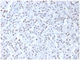 Wilm's Tumor 1 (WT1) (Wilm's Tumor & Mesothelial Marker), CF488A conjugate, 0.1mg/mL