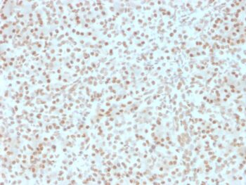 AKT1 (Prognostic Marker for Neuroendocrine Tumors)(AKT1/2491), CF594 conjugate, 0.1mg/mL