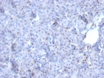 AKT1 (Prognostic Marker for Neuroendocrine Tumors)(AKT1/2784), CF647 conjugate, 0.1mg/mL