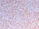 ALK (Anaplastic Lymphoma Kinase) / CD246(ALK/3218R), CF405S conjugate, 0.1mg/mL