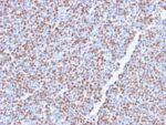 ALK (Anaplastic Lymphoma Kinase) / CD246(ALK1/2766R), CF488A conjugate, 0.1mg/mL