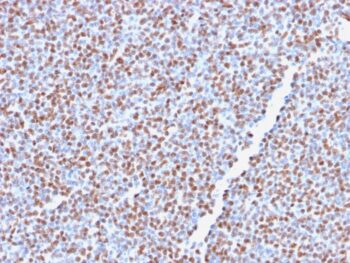 ALK (Anaplastic Lymphoma Kinase) / CD246(ALK1/2766R), CF488A conjugate, 0.1mg/mL