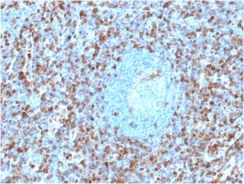 Annexin A1 / (Hairy Cell Leukemia Marker)(ANXA1/1671), 0.2mg/mL