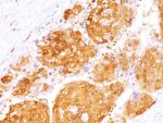 Arginase 1 (Hepatocellular Carcinoma Marker)(ARG1/1125+ ARG1/1126), CF405S conjugate, 0.1mg/mL 1 view_image-235
