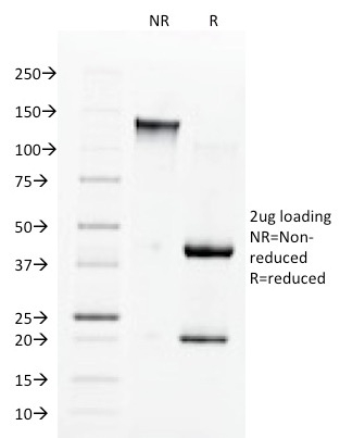 Angiotensin I Converting Enzyme (ACE) / CD143(9B9), CF594 conjugate, 0.1mg/mL