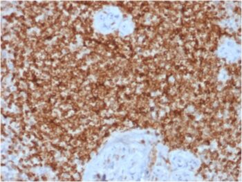 Bcl-2 (Apoptosis & Follicular Lymphoma Marker) (BCL2/1878R), CF488A conjugate, 0.1mg/mL