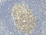 Bcl-6 (Follicular Lymphoma Marker)(BCL6/1951R), 1mg/mL