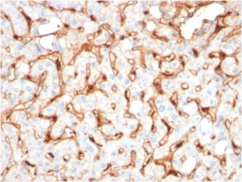 C1QB / Complement C1q B-Chain(C1QB/2965), 1mg/mL