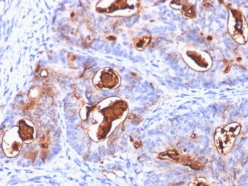 Carcinoembryonic Antigen (CEA) / CD66(C66/1260), CF488A conjugate, 0.1mg/mL