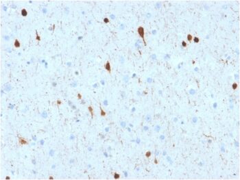 Calretinin / Calbindin 2 (Mesothelioma Marker)(CALB2/2602), CF740 conjugate, 0.1mg/mL