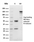 Cyclin D1 (G1-Cyclin & Mantle Cell Lymphoma Marker)(CCND1/3548), 0.2mg/mL