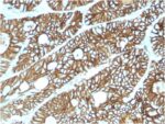 Cadherin 17 / LI Cadherin (Liver-Intestine Marker)(CDH17/2615), CF488A conjugate, 0.1mg/mL