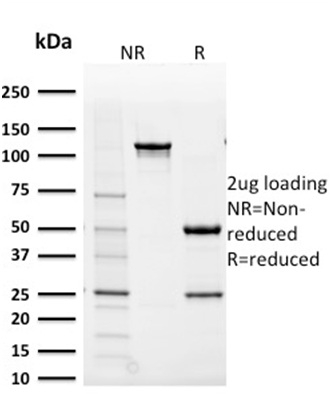 Aldo-keto Reductase Family 1 Member B1 (Adrenal Marker)(CPTC-AKR1B1-2), CF405S conjugate, 0.1mg/mL