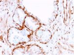 Aldo-keto Reductase Family 1 Member B1 (Adrenal Marker)(CPTC-AKR1B1-3), CF640R conjugate, 0.1mg/mL