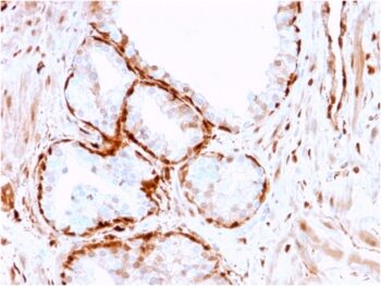 Aldo-keto Reductase Family 1 Member B1 (Adrenal Marker)(CPTC-AKR1B1-3), CF640R conjugate, 0.1mg/mL