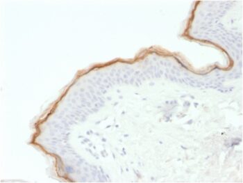 Filaggrin (Keratinocyte Differentiation Marker)(FLG/1563), 1mg/mL
