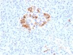 Ferritin, Light Chain (Node-Negative Breast Tumor Prognostic Marker)(FTL/1387), 1mg/mL