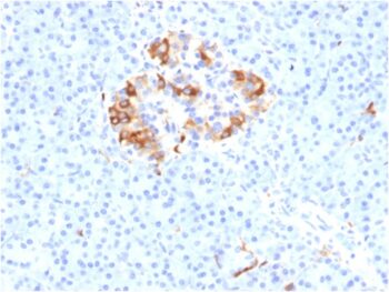 Ferritin, Light Chain (Node-Negative Breast Tumor Prognostic Marker)(FTL/1387), 1mg/mL