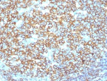 CD20 / MS4A1 (B-Cell Marker) (IGEL/1497R), CF594 conjugate, 0.1mg/mL