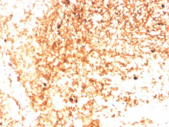 Human IgM (Immunoglobulin Mu Heavy Chain) (B-Cell Marker)(IGHM/3803R), CF647 conjugate, 0.1mg/mL
