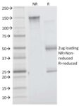 Insulin Receptor Alpha(INSR/1661), CF405S conjugate, 0.1mg/mL