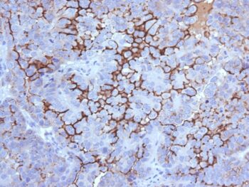 MUC16 / CA125 (Ovarian Carcinoma Marker)(500000000000), CF740 conjugate, 0.1mg/mL