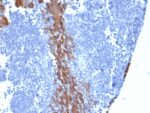 Cytokeratin 13 (Non-Keratinized Squamous Epithelial Marker)(KRT13/2213), 0.2mg/mL 1 view_image-518