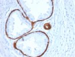 Cytokeratin 14 (KRT14) (Squamous Cell Marker)(KRT14/2375), CF594 conjugate, 0.1mg/mL