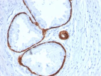 Cytokeratin 14 (KRT14) (Squamous Cell Marker)(KRT14/2375), CF594 conjugate, 0.1mg/mL